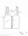 Fig. 02 - Compression bandage for breast operated