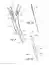 Fig. 04 - Method and apparatus for treating a carotid artery