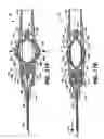 Fig. 09 - Apparatus for delivery of ocular implants