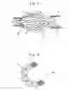 Fig. 07 - Medical treating tool