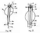 Fig. 05 - Suturing device for implantable device