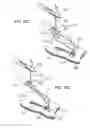Fig. 41 - Sew-right running stitch instrument