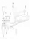Fig. 13 - Running stitch suturing device