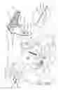 Fig. 57 - Running stitch suturing device