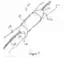 Fig. 02 - Endoluminal access devices and related methods of use
