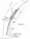 Fig. 04 - Endoluminal access devices and related methods of use