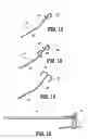 Fig. 08 - Methods and devices for blood vessel harvesting