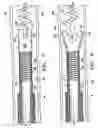 Fig. 04 - Implant delivery assembly with expandable coupling/decoupling mechanism
