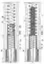 Fig. 07 - Implant delivery assembly with expandable coupling/decoupling mechanism