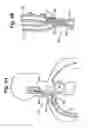 Fig. 05 - Baroreflex activation for pain control, sedation and sleep