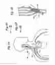 Fig. 07 - Baroreflex activation for pain control, sedation and sleep