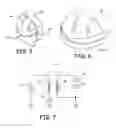 Fig. 04 - Method for reducing implantable defibrillator volume