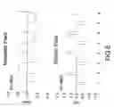 Fig. 09 - Method and system to provide therapy for neuropsychiatric disorders and cognitive impairments using gradient magnetic pulses to the brain and pulsed electrical stimulation to vagus nerve(s)