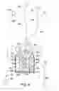 Fig. 04 - Implanted antenna and radio communications link