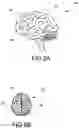 Fig. 03 - Articulated neural electrode assembly