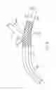 Fig. 07 - Bifurcated stent delivery system