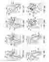 Fig. 11 - System and method for endoluminal grafting of bifurcated and branched vessels