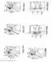 Fig. 12 - System and method for endoluminal grafting of bifurcated and branched vessels