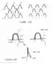 Fig. 27 - Reinforced graft