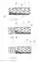 Fig. 03 - Biliary stent-graft