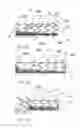 Fig. 04 - Biliary stent-graft