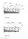 Fig. 05 - Biliary stent-graft