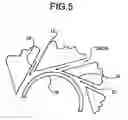 Fig. 06 - Stent reducing system and device