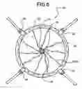 Fig. 07 - Stent reducing system and device