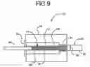 Fig. 10 - Stent reducing system and device