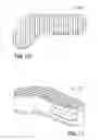 Fig. 09 - Vertebral body replacement apparatus and method