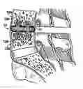 Fig. 01 - Method, system and apparatus for interbody fusion