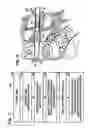 Fig. 03 - Method, system and apparatus for interbody fusion