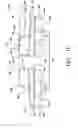 Fig. 04 - Laterally insertable artificial vertebral disk replacement implant with translating pivot point