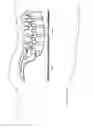 Fig. 01 - Interconnected spinal device and method