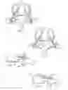 Fig. 04 - Interconnected spinal device and method