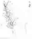 Fig. 02 - Acromioclavicular joint prosthesis