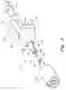 Fig. 04 - Acromioclavicular joint prosthesis