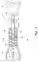 Fig. 06 - Acromioclavicular joint prosthesis