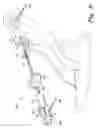 Fig. 07 - Acromioclavicular joint prosthesis
