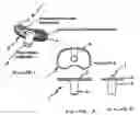 Fig. 02 - Modular phrosthesis assembly including tapered adjustments