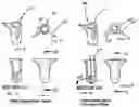 Fig. 05 - Modular phrosthesis assembly including tapered adjustments
