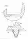 Fig. 02 - Complete knee prosthesis