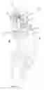 Fig. 04 - Prosthetic knee mechanism