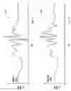 Fig. 05 - Vehicle rollover detection and method of anticipating vehicle rollover