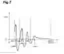Fig. 08 - Apparatus and method for voice activity detection