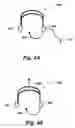 Fig. 06 - Method and apparatus of simulating and stimulating human speech and teaching humans how to talk