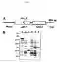 Fig. 15 - Desmin gene having novel point mutation causative of dilated cardiomyopathy