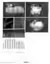 Fig. 05 - Rabbit nuclear cloning method and uses thereof