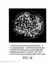 Fig. 19 - Isoforms of eIF-5A: senescence-induced eLF5A; wounding-induced eIF-4A; growth eIF-5A; and DHS