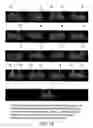 Fig. 20 - Isoforms of eIF-5A: senescence-induced eLF5A; wounding-induced eIF-4A; growth eIF-5A; and DHS